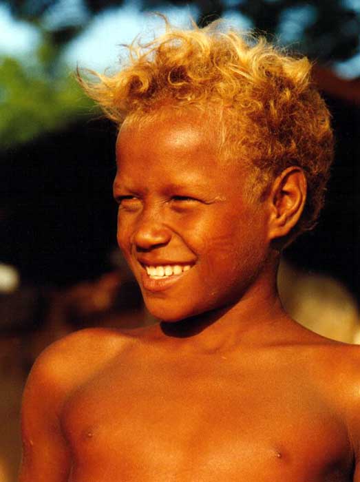 blonde hair is not unusual among aboriginal children